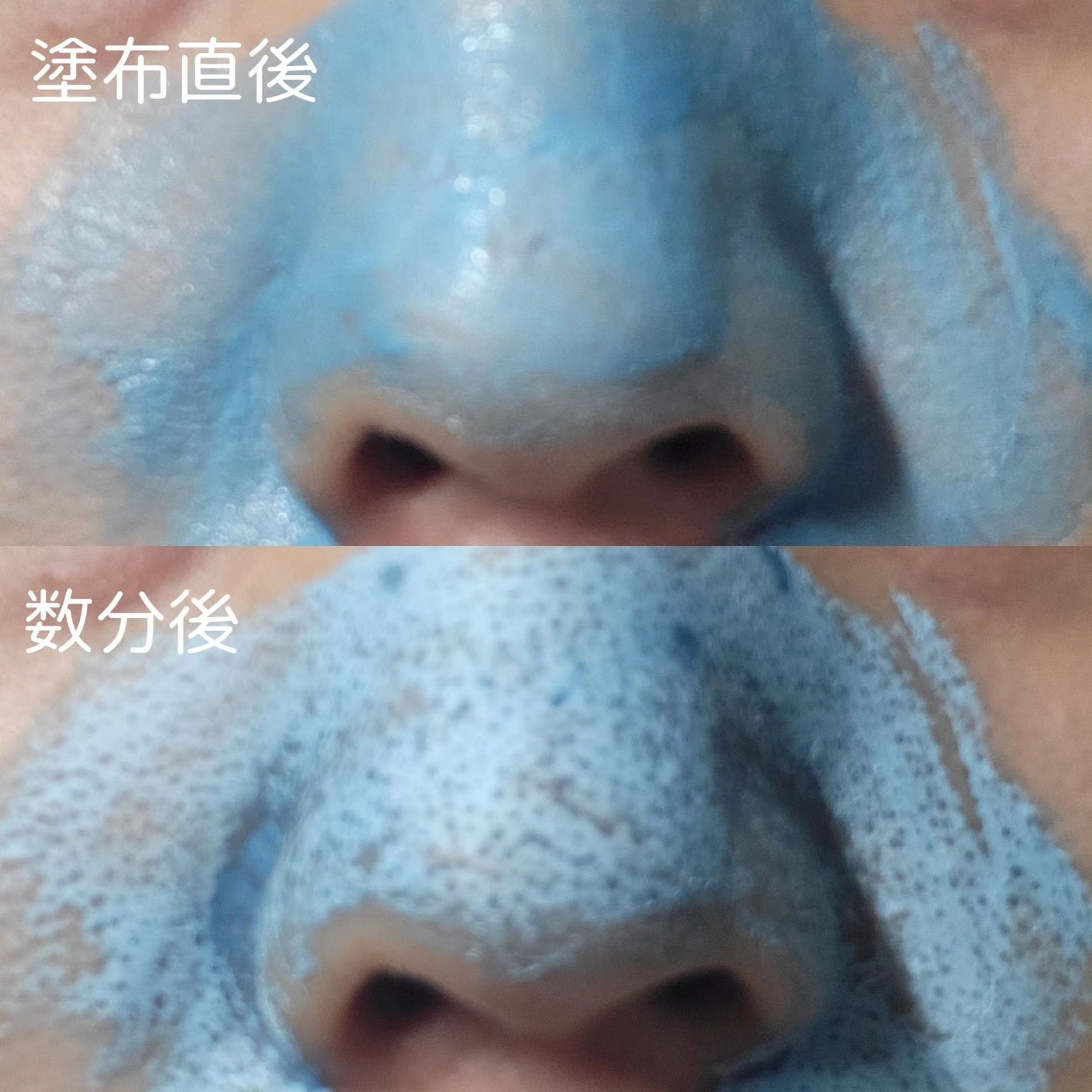 ゼロ毛穴クレイパック/MEDICUBE/洗い流すパック・マスクを使ったクチコミ(3枚目)