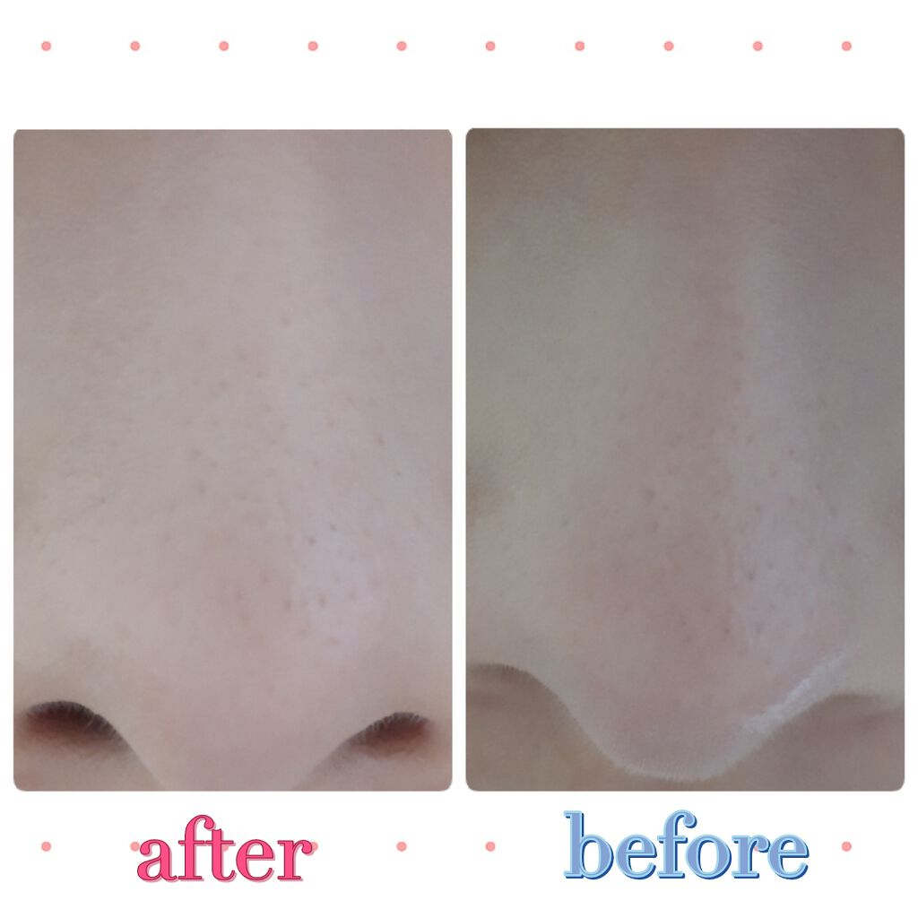 天然こんにゃくパフ/DAISO/その他スキンケアグッズを使ったクチコミ(2枚目)