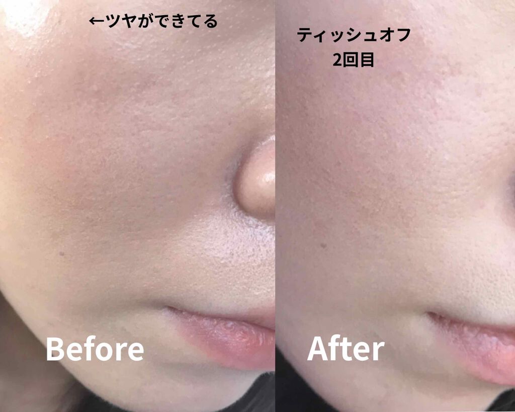 【旧】ディオールスキン フォーエヴァー フルイド グロウ/Dior/リキッドファンデーションを使ったクチコミ(2枚目)