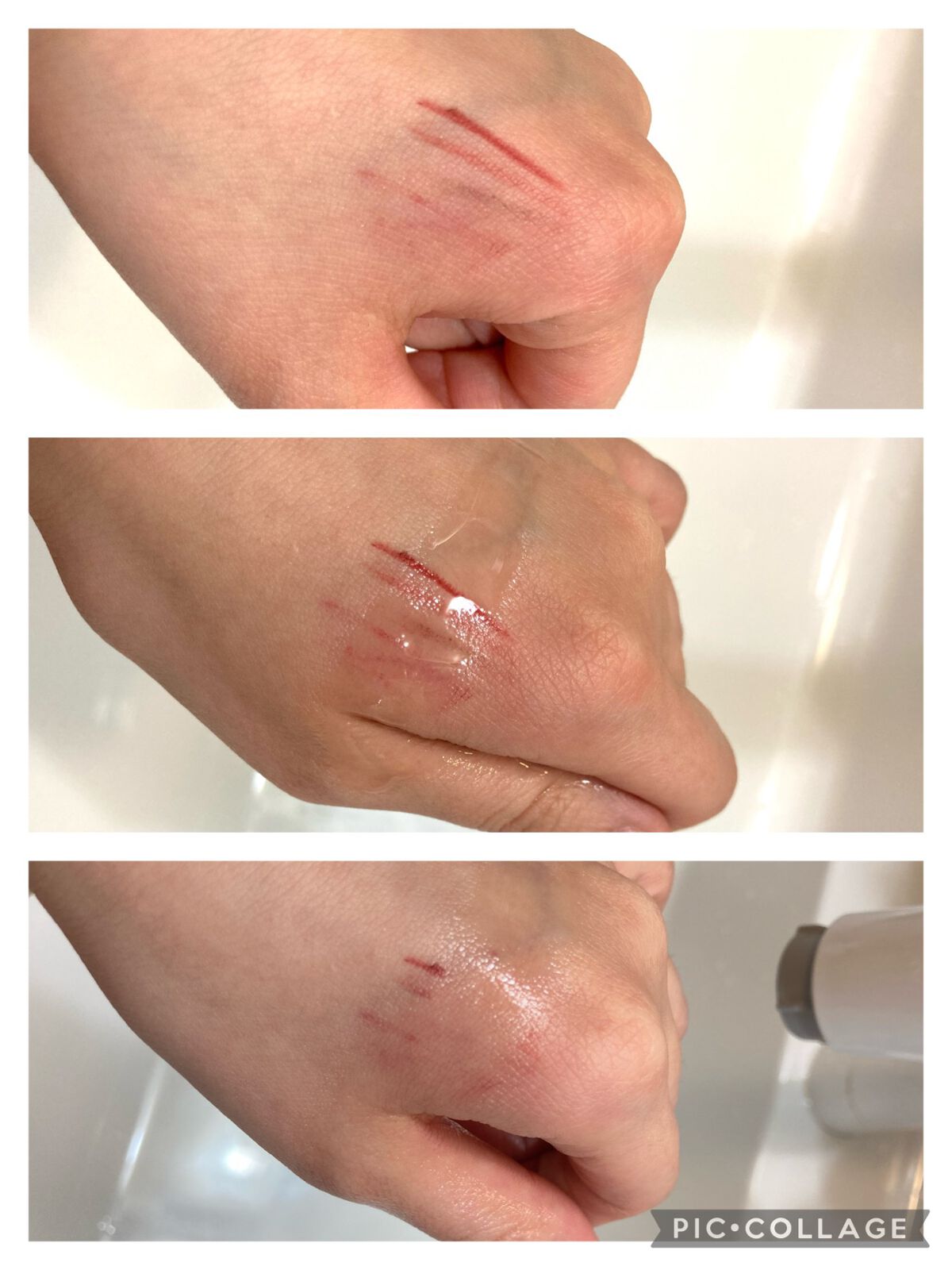 ピンクハーブクレンジング/ACNAL/オイルクレンジングを使ったクチコミ(3枚目)