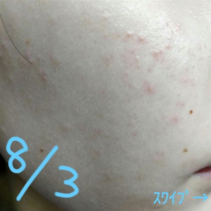 åç²§æ°Žã»ææèçšã»ãã£ãšãã¿ã€ã/ç¡å°è¯å/åç²§æ°Žã䜿ã£ãã¯ãã³ãïŒ2æç®ïŒ