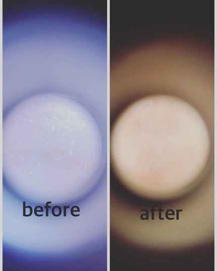 Carrie125 on LIPS 「VT肌レスキュー隊 第2期に応募させていただき、素敵な商品を当..」(8枚目)