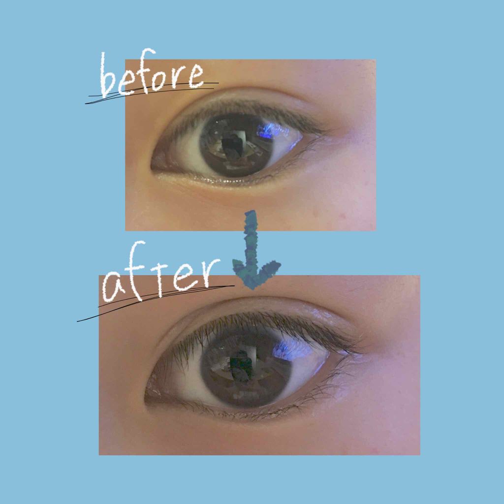 【旧品】オリシキ アイリッドスキンフィルム/D-UP/二重まぶた用アイテムを使ったクチコミ(2枚目)