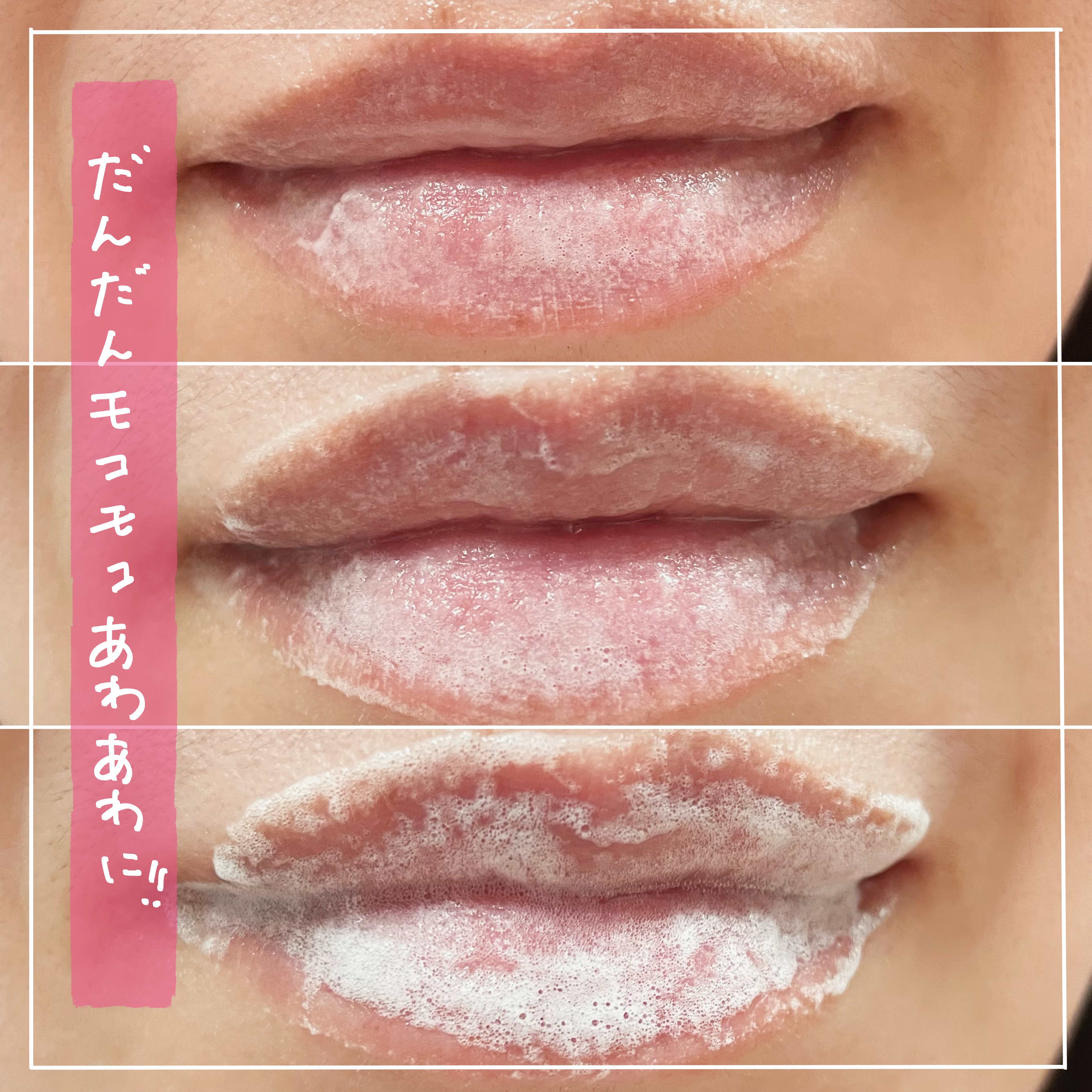 ブビブビ リップマスク/unpa/リップマスクを使ったクチコミ（3枚目）