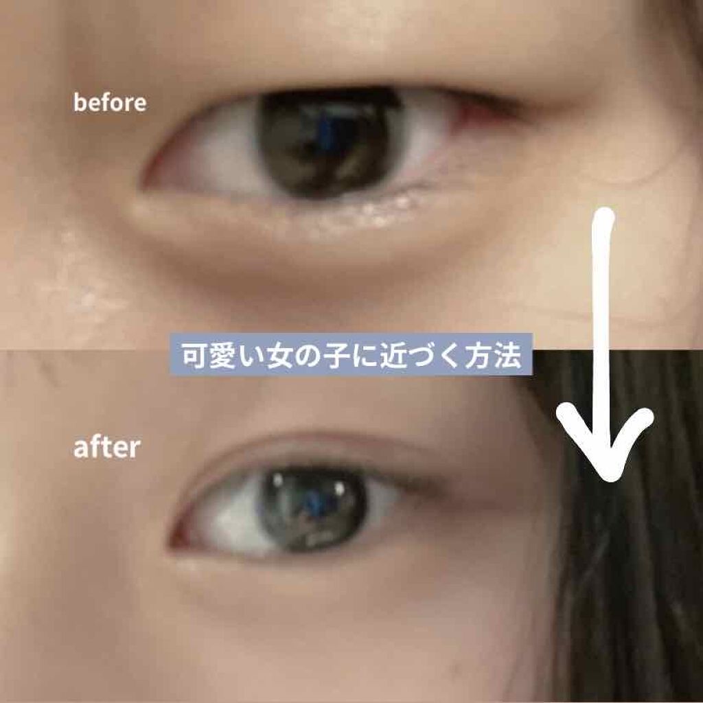 のびーるアイテープ（絆創膏タイプ、レギュラー）/DAISO/二重まぶた用アイテムを使ったクチコミ（1枚目）