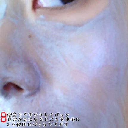 毛穴小町 テカリ源治 マスク/クリアターン/シートマスク・パックを使ったクチコミ(4枚目)