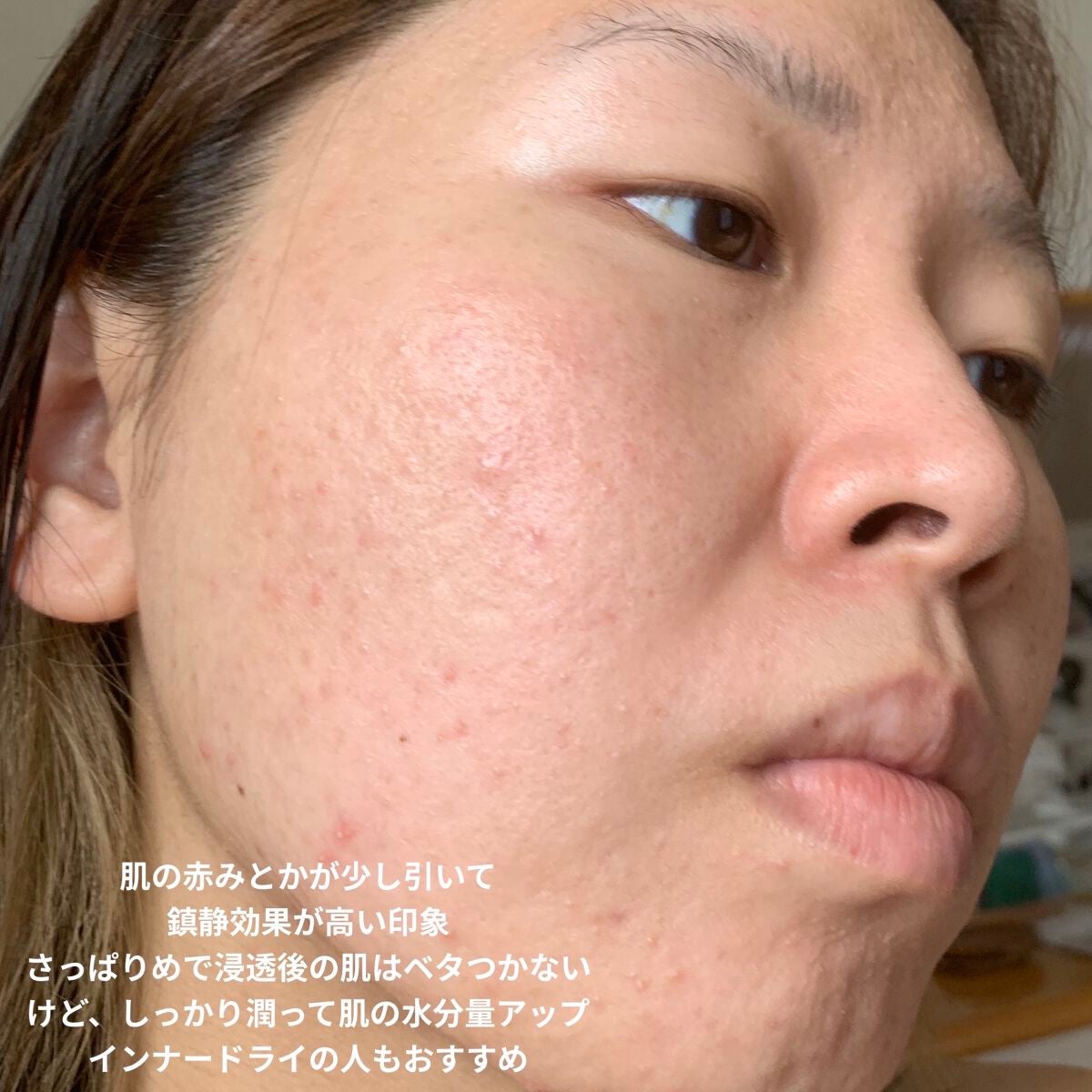 ドクダミトナーデイリーシートマスク/Anua/シートマスク・パックを使ったクチコミ(7枚目)