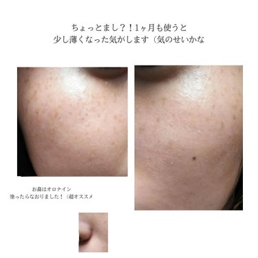 薬用しみ対策 美白化粧水 しっとりタイプ/メラノCC/化粧水を使ったクチコミ（2枚目）