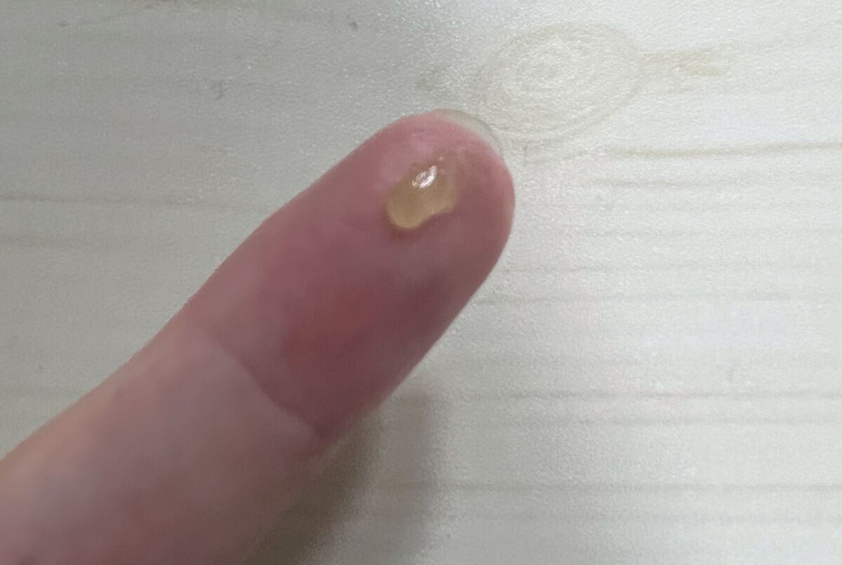 キールズ リップ バーム No.1/Kiehl's/リップバームを使ったクチコミ(2枚目)