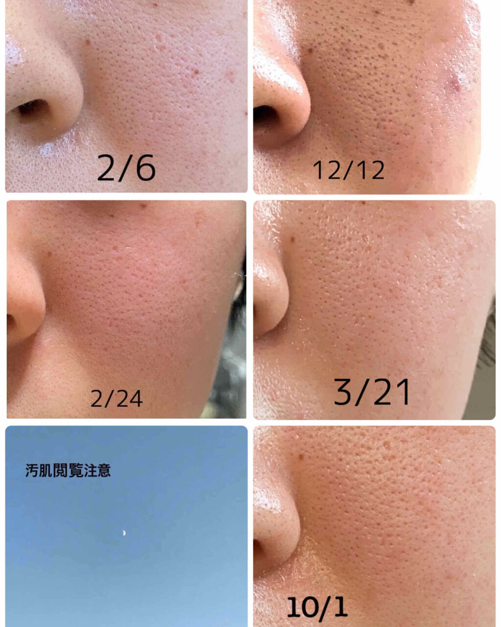 ファイバーフォーム/ルナメアAC/洗顔フォームを使ったクチコミ（2枚目）