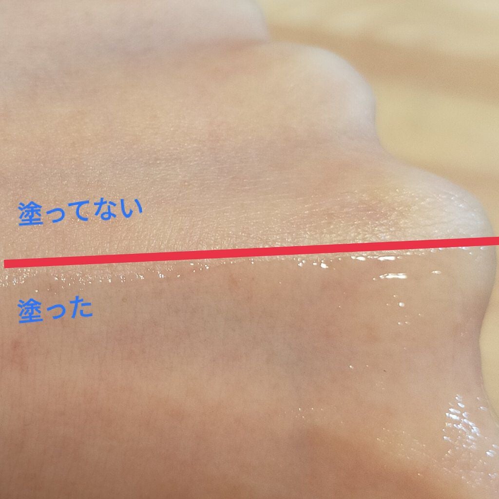 ティーツリーカーミングハイドロジェル/MEDIHEAL/ボディローションを使ったクチコミ(2枚目)