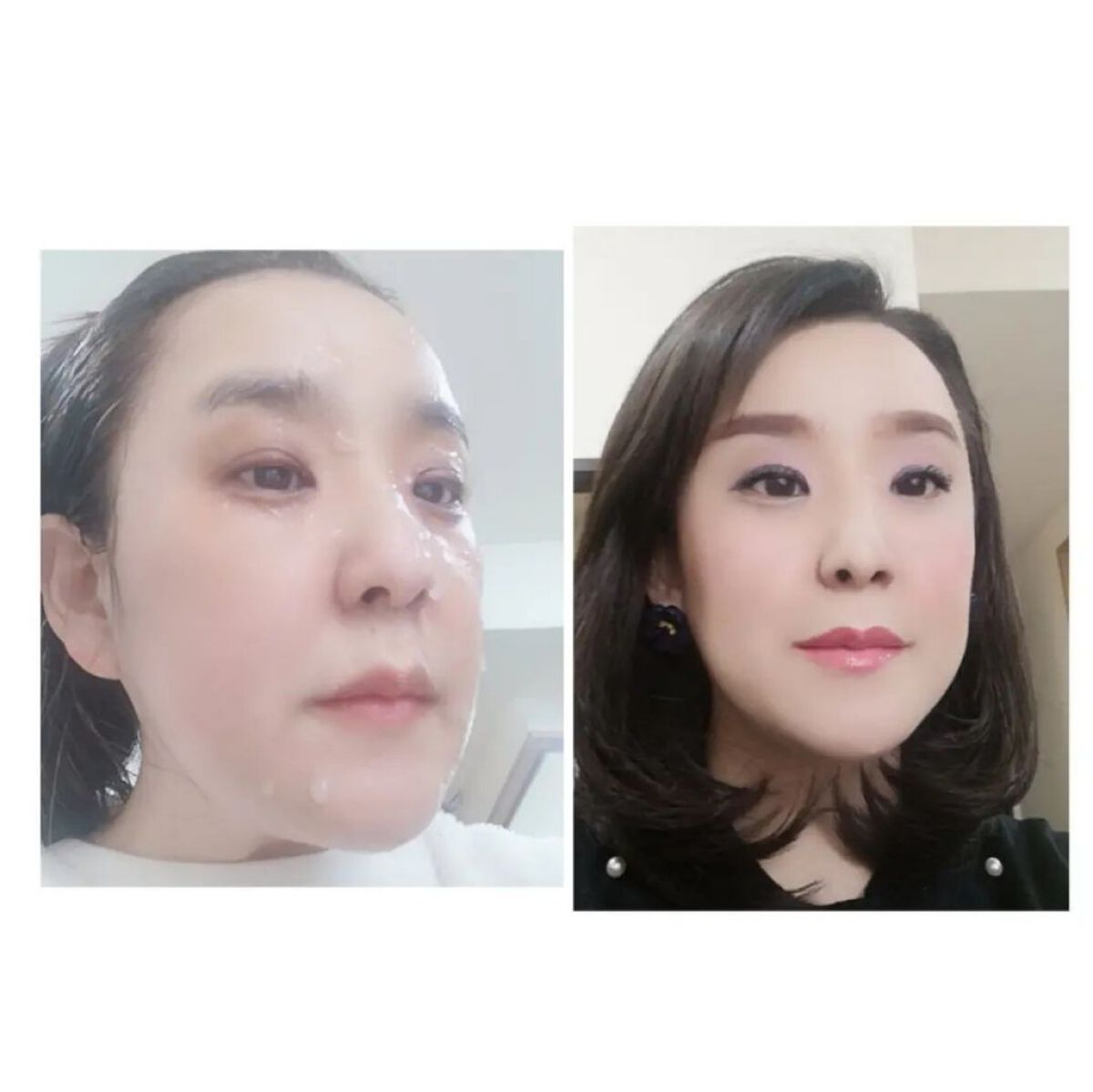 美白乃美人ピーリングジェル/ブレーンコスモス/ピーリングを使ったクチコミ（3枚目）