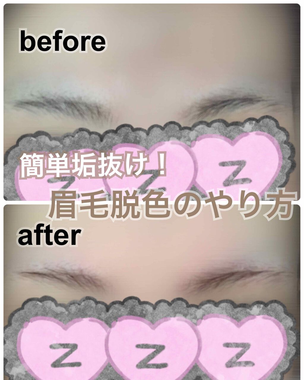 脱色クリーム スピーディー/エピラット/ムダ毛ケアを使ったクチコミ(1枚目)