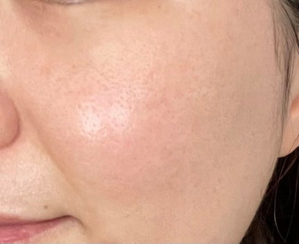 ビタオンチアフルミスト/VITAON/ミスト状化粧水を使ったクチコミ(3枚目)