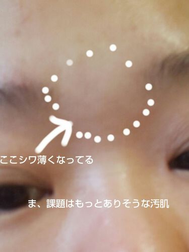 19年秋新作コスメ ムヒパッチa 医薬品 ムヒの口コミ 箱捨ててもーた かわいいイラスト入り ワ By ゆい 乾燥肌 代後半 Lips
