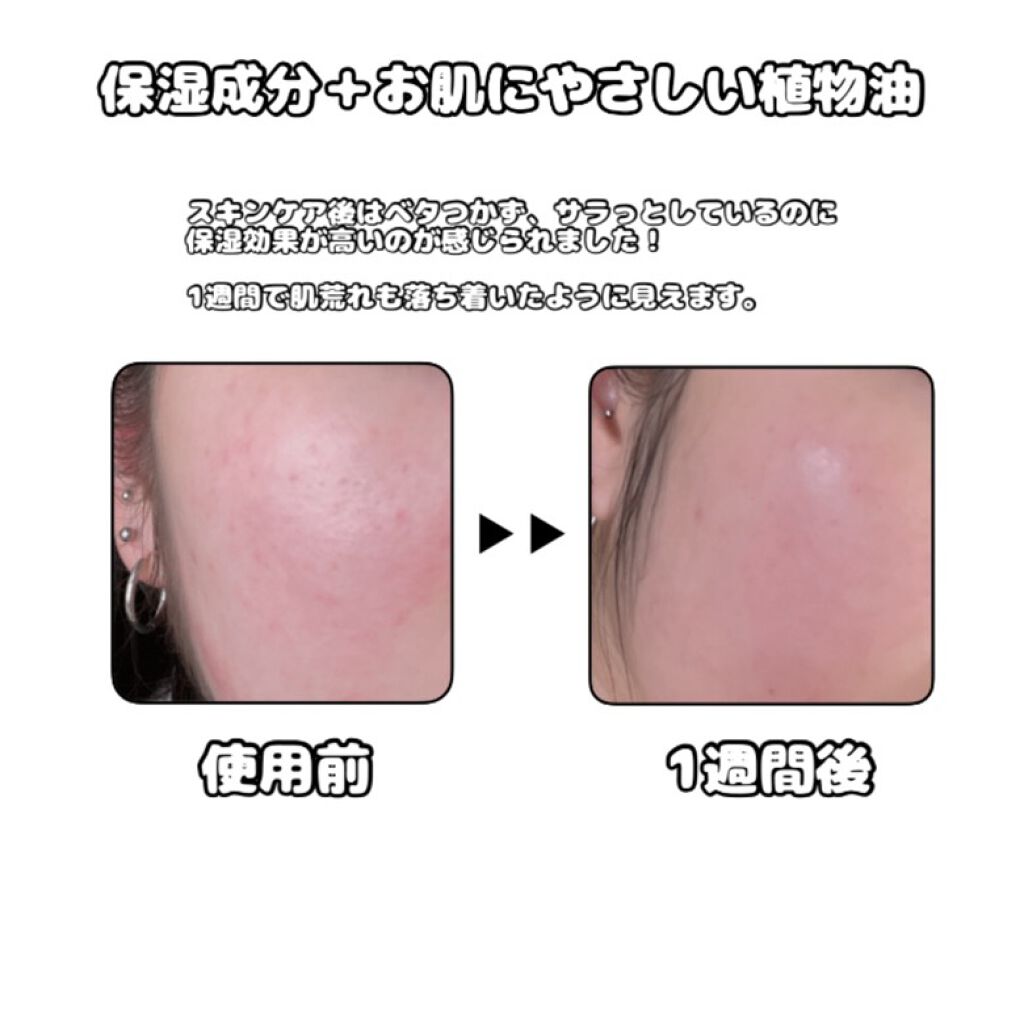 リムヴェール　スキンケアローション/リムサプライ/ボディローションを使ったクチコミ（2枚目）