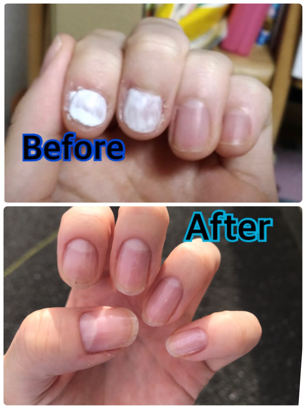 ネイルケアオイル/無印良品/ネイルオイル・トリートメントを使ったクチコミ(1枚目)