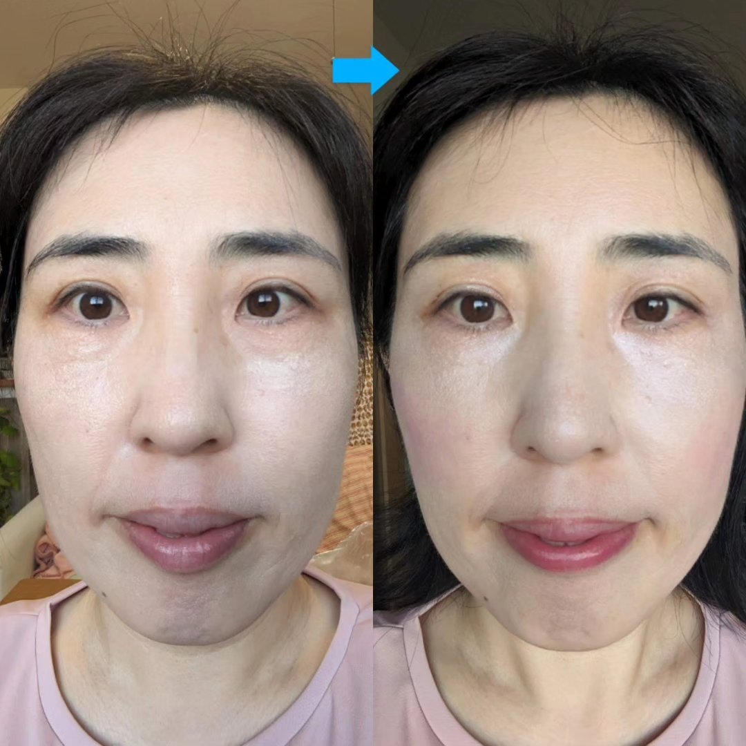 むにゅっとハイライター/キャンメイク/クリームハイライトを使ったクチコミ（1枚目）