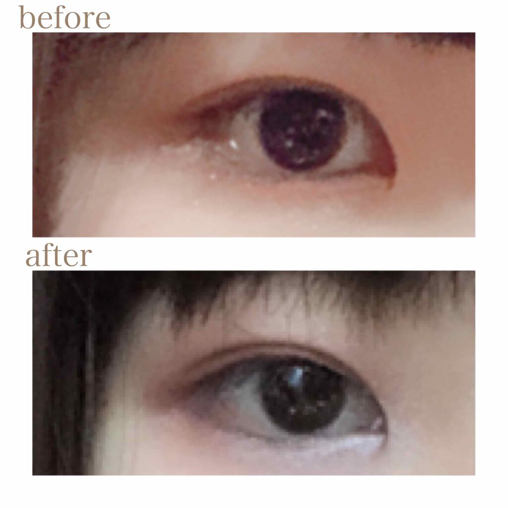 オリシキ アイリッドスキンフィルム		/D-UP/二重まぶた用アイテムを使ったクチコミ（2枚目）