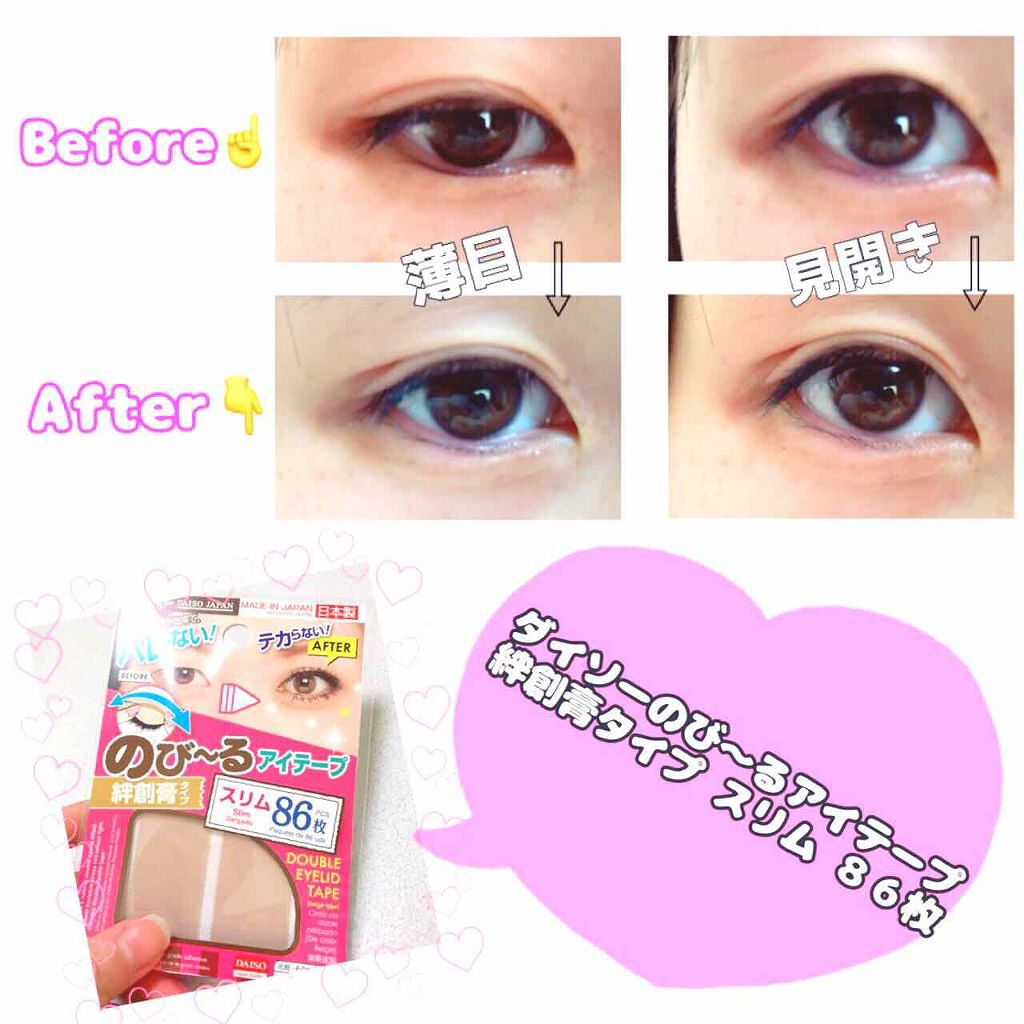 のびーるアイテープ（絆創膏タイプ、レギュラー）/DAISO/二重まぶた用アイテムを使ったクチコミ（1枚目）