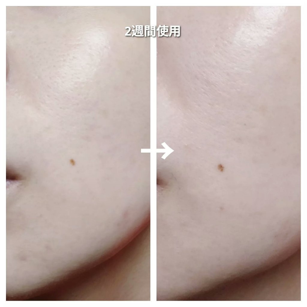 シカバイタル マスク/VT/シートマスク・パックを使ったクチコミ（2枚目）