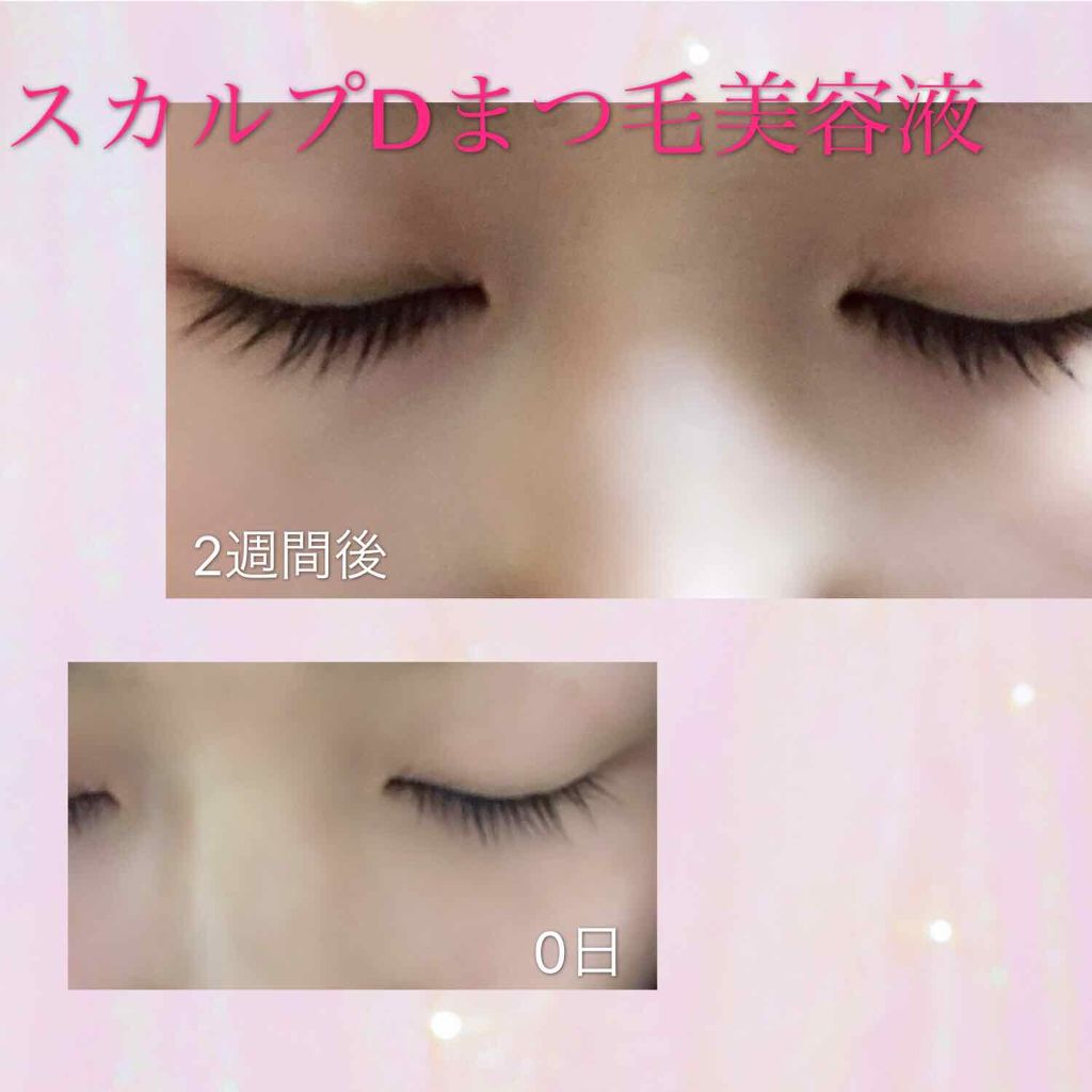 スカルプD ボーテ ピュアフリーアイラッシュセラム/アンファー(スカルプD)/まつげ美容液を使ったクチコミ（1枚目）