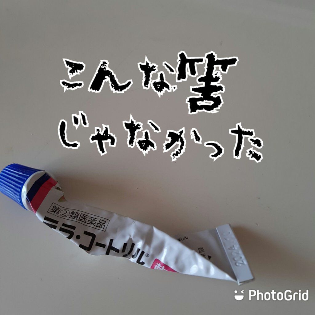 テラ・コートリル 軟膏(医薬品)/ジョンソン・エンド・ジョンソン/その他を使ったクチコミ(1枚目)