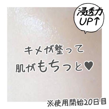 my's パーソナライズセラム/my's/美容液を使ったクチコミ(2枚目)