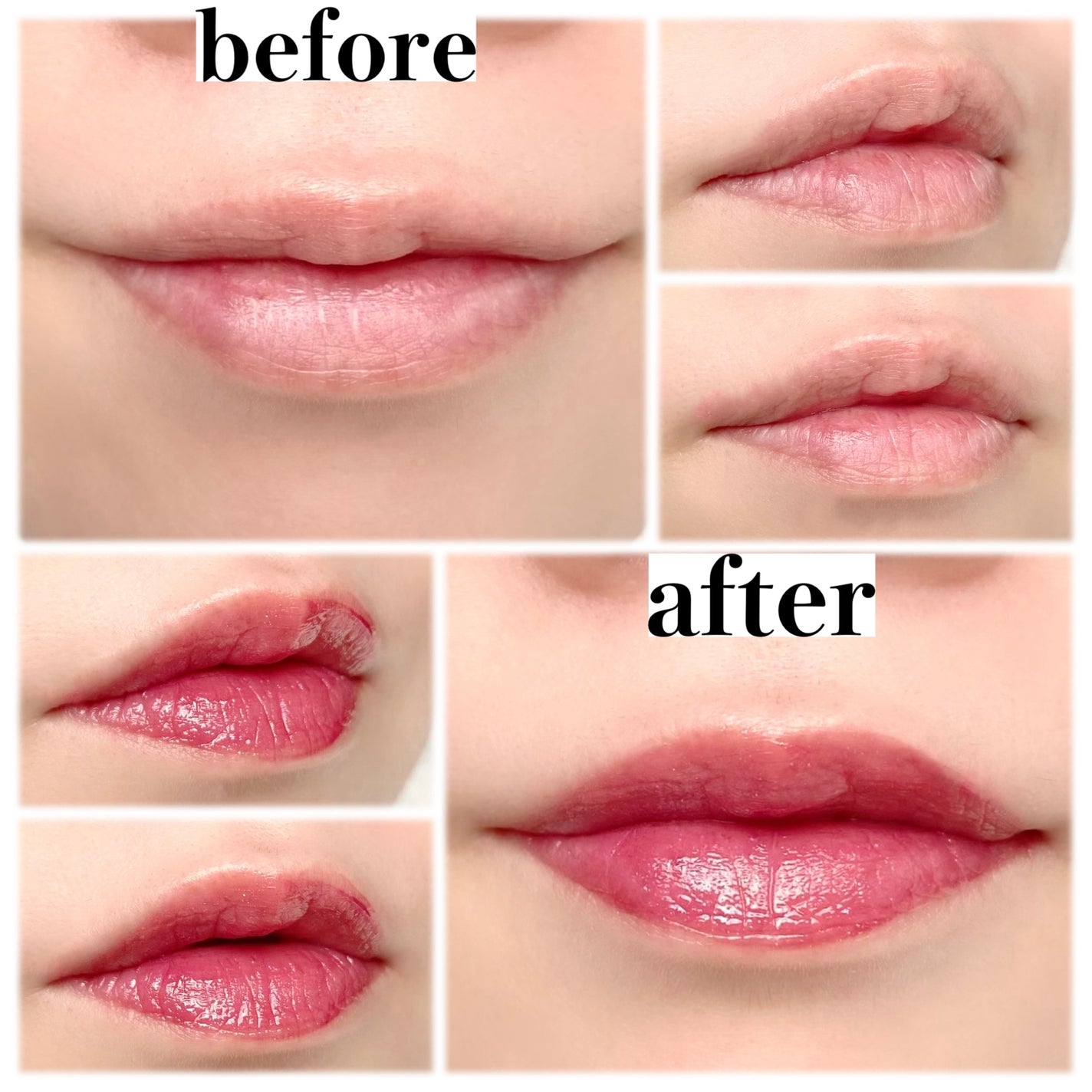 リップアーマー/KiSS/口紅を使ったクチコミ(4枚目)