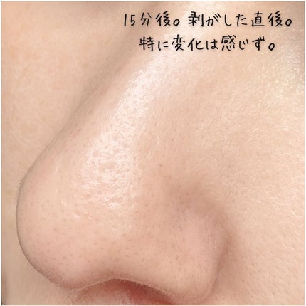 ノーズピーリングパック/One-day's you/シートマスク・パックを使ったクチコミ(6枚目)