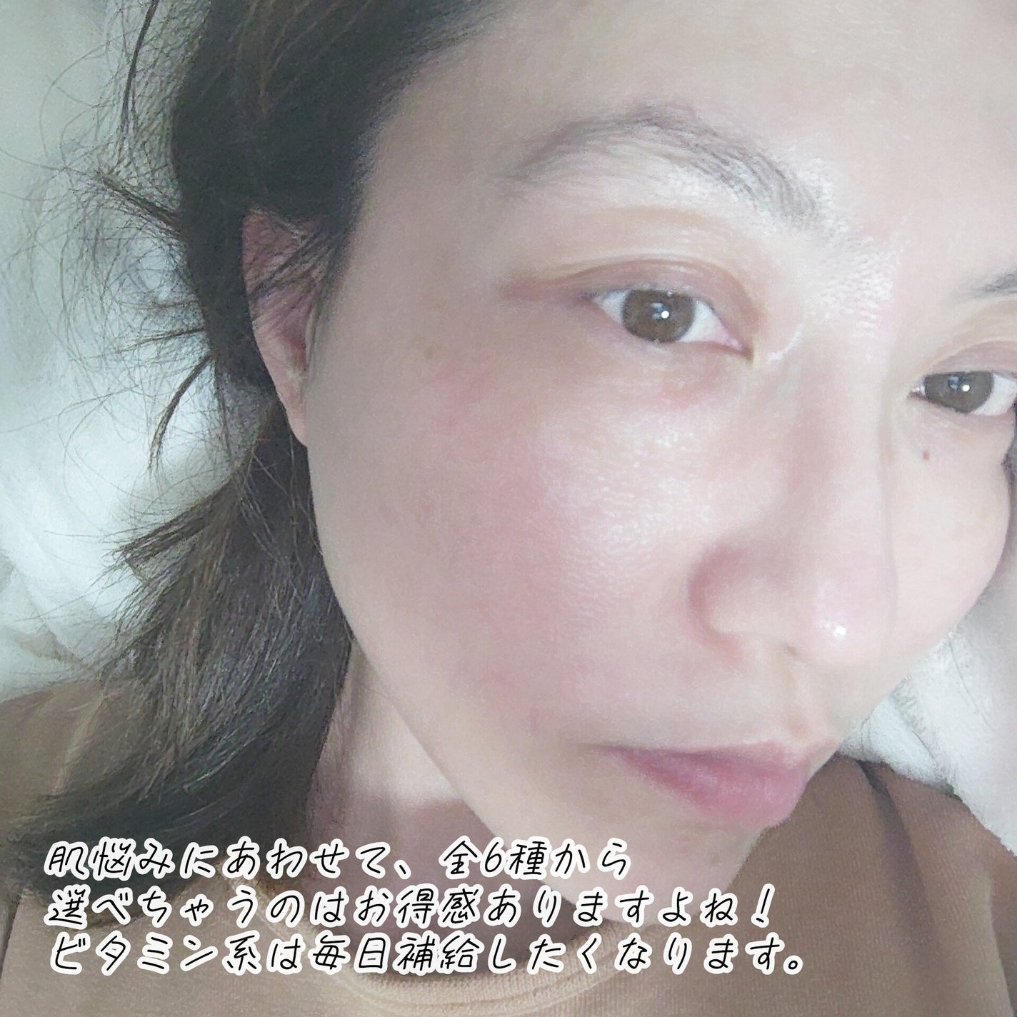 S100 ビタライトリードル/VT/美容液を使ったクチコミ(3枚目)