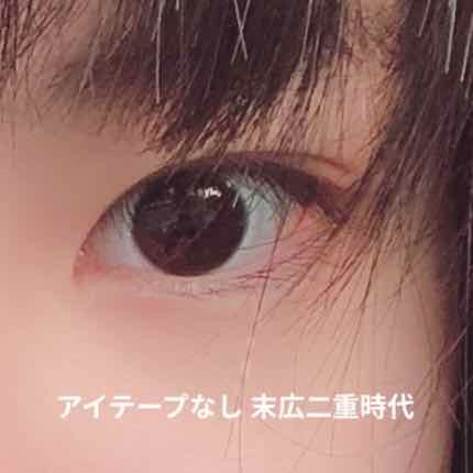 のびーるアイテープ(絆創膏タイプ、レギュラー)/DAISO/二重まぶた用アイテムを使ったクチコミ(2枚目)