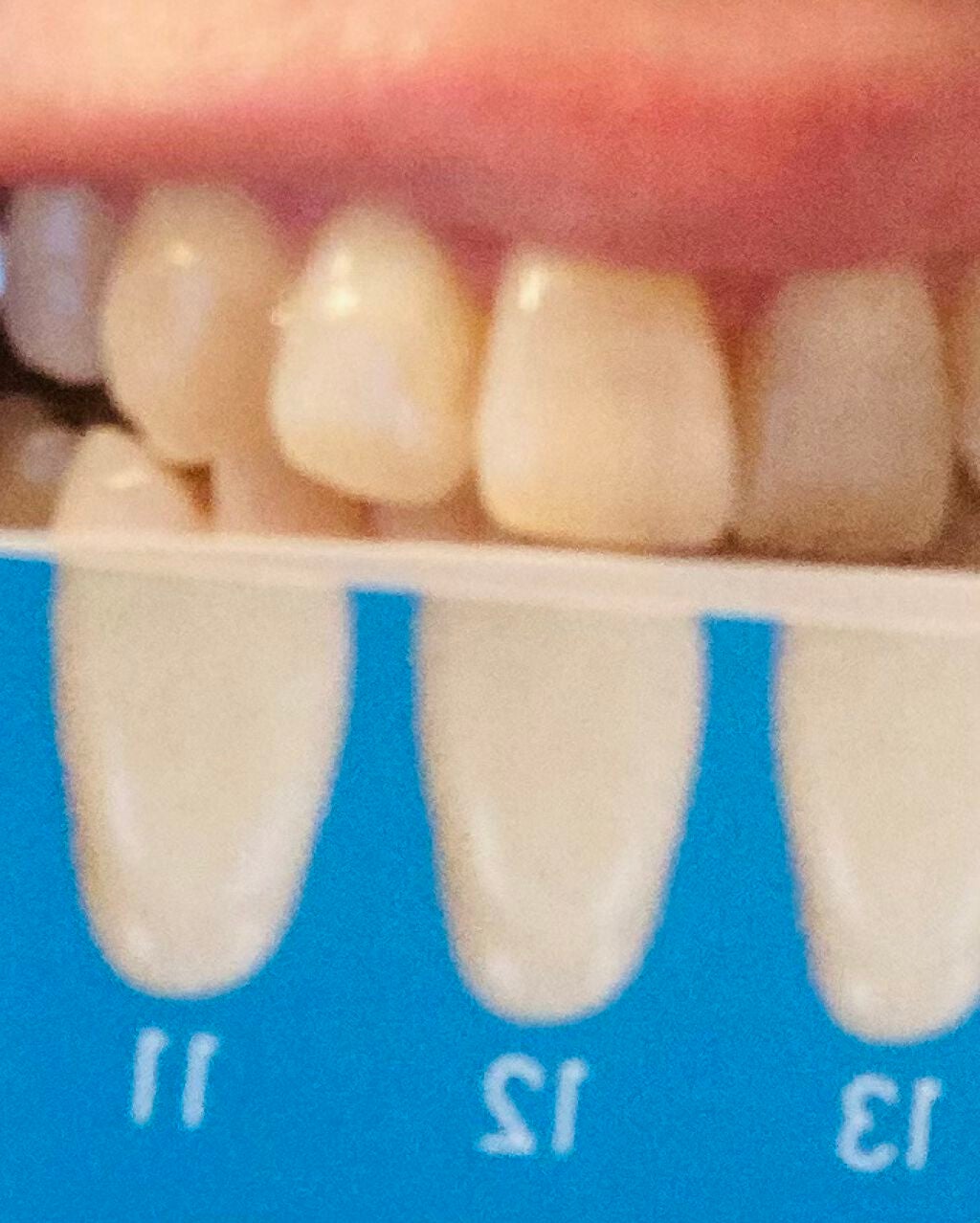 Dr.USB ホワイトニング専用LEDライト/WHITE CLUB/その他オーラルケアを使ったクチコミ(4枚目)