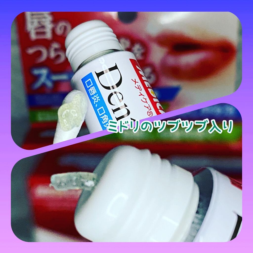 デンタルピルクリーム(医薬品)/メディケア/その他を使ったクチコミ(3枚目)