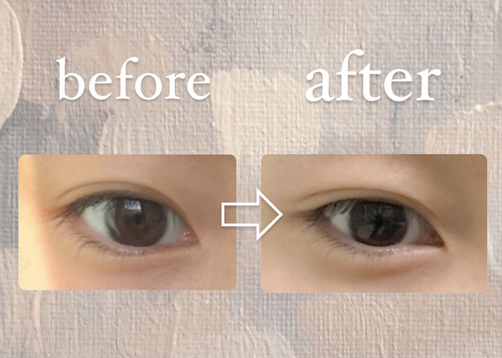 オリシキ アイリッドスキンフィルム		/D-UP/二重まぶた用アイテムを使ったクチコミ（2枚目）