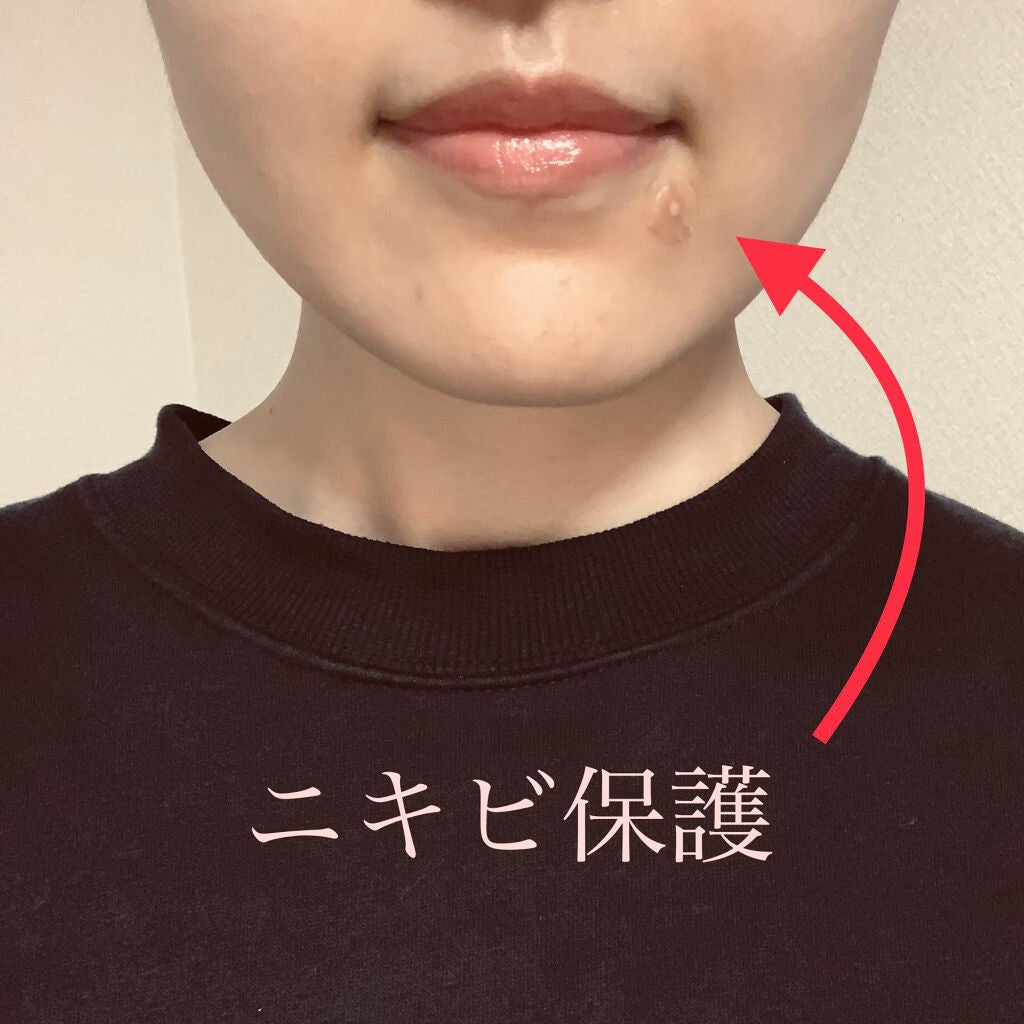 ゼロスポットパッチ/Today’s Cosme/にきびパッチを使ったクチコミ(1枚目)