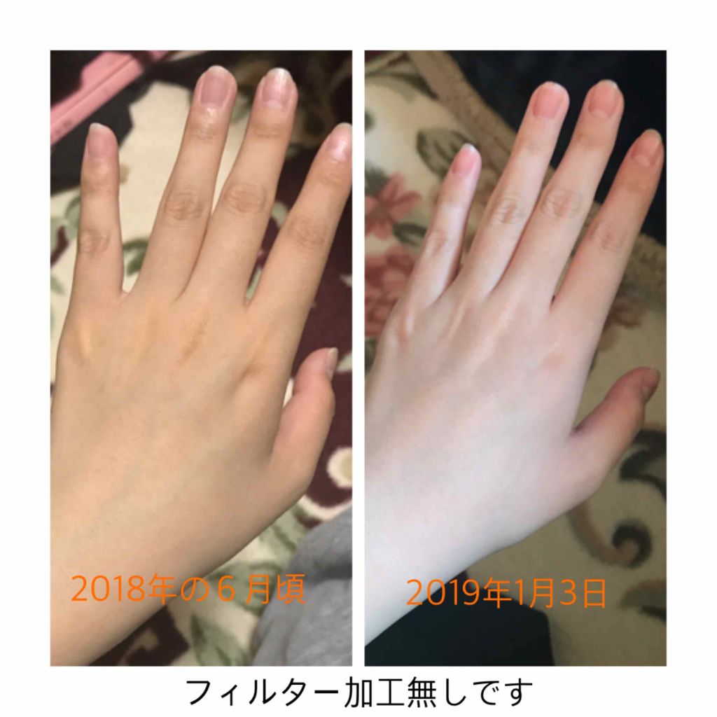 ハトムギ保湿ジェル(ナチュリエ スキンコンディショニングジェル)/ナチュリエ/美容液を使ったクチコミ(4枚目)