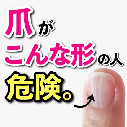 あなたの肌に合ったスキンケア💐コーくん先生 on LIPS 「【当てはまったらヤバい】爪がこんな形の人危険です🚨..あなたの..」(1枚目)