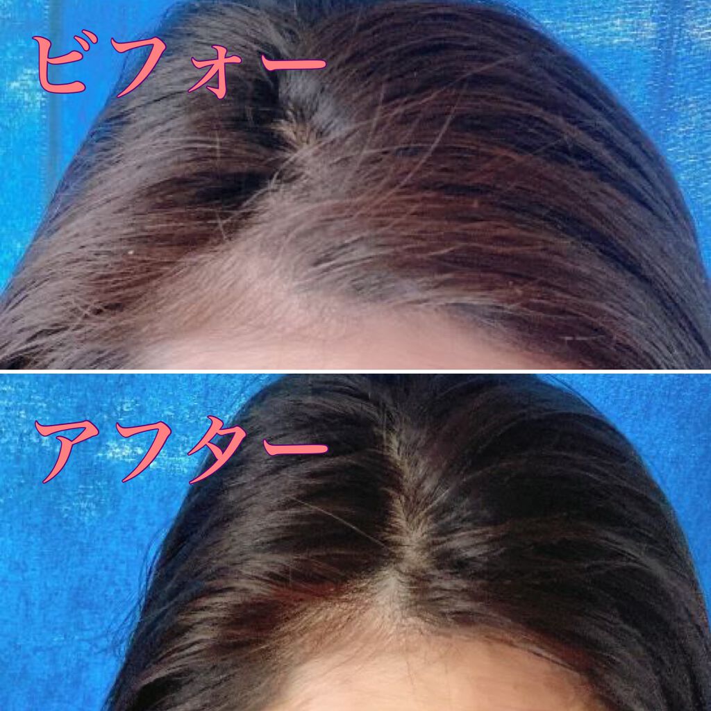 エクセランス R クリームタイプ /ロレアル パリ/ヘアカラーを使ったクチコミ(2枚目)