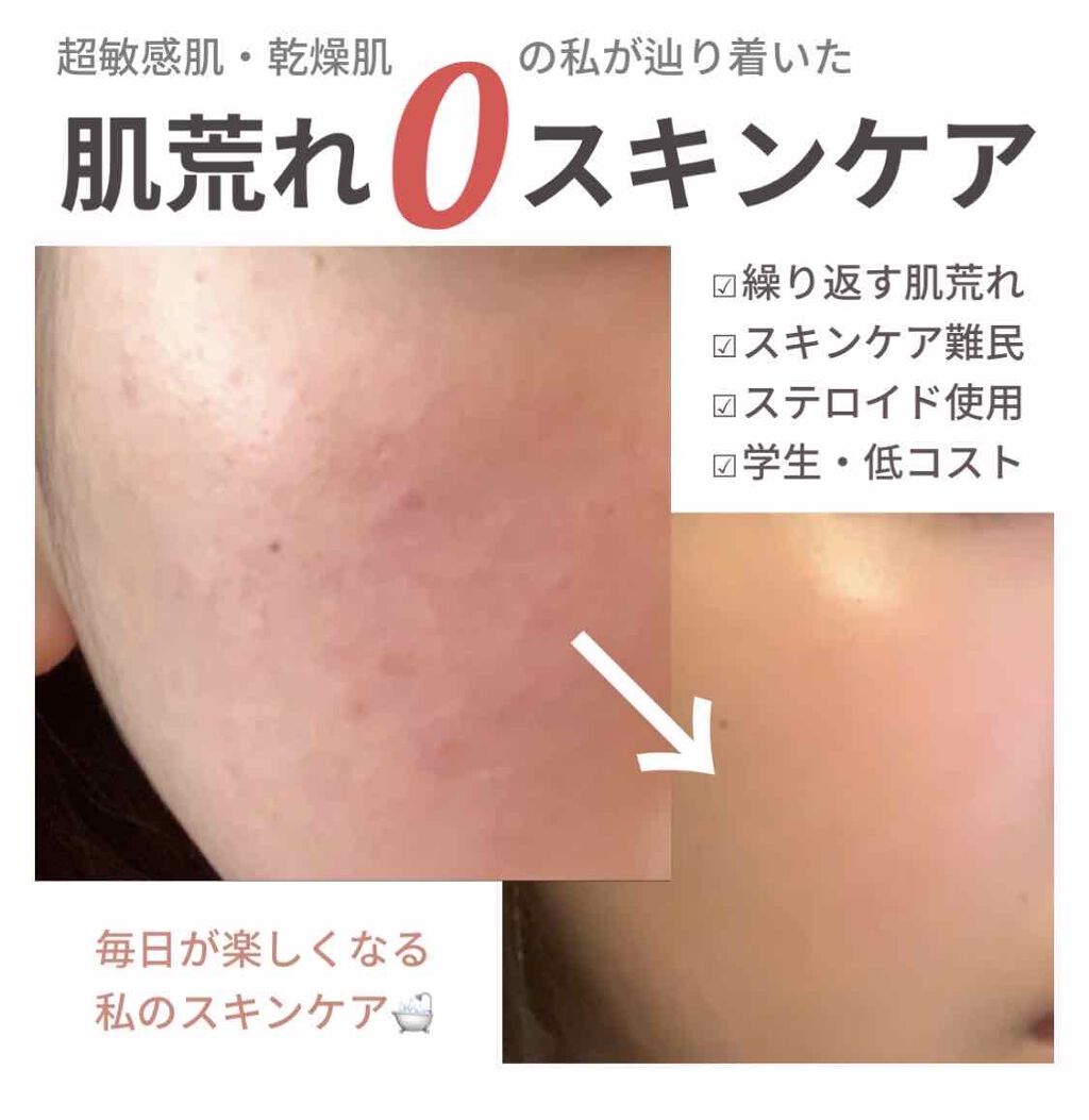 サンシビオ エイチツーオー D/ビオデルマ/クレンジングウォーターを使ったクチコミ(1枚目)