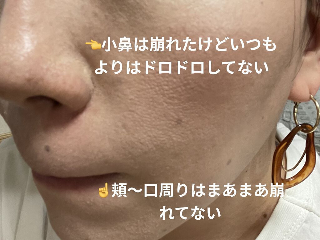 フェイスクリーム/アセトメル/フェイスクリームを使ったクチコミ（2枚目）