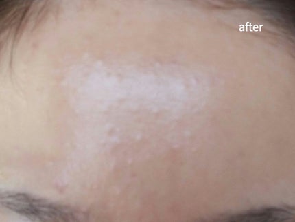 エンハンサー/ニュースキン/美容液を使ったクチコミ(1枚目)