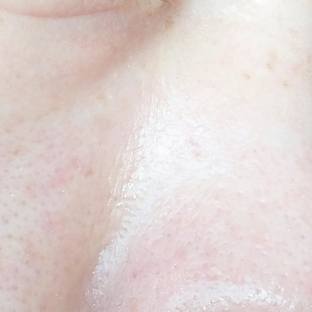 seiko_official on LIPS 「\肌のクリーニング/🟥韓国🟦#メディピール#MEDIPEEL@..」(7枚目)