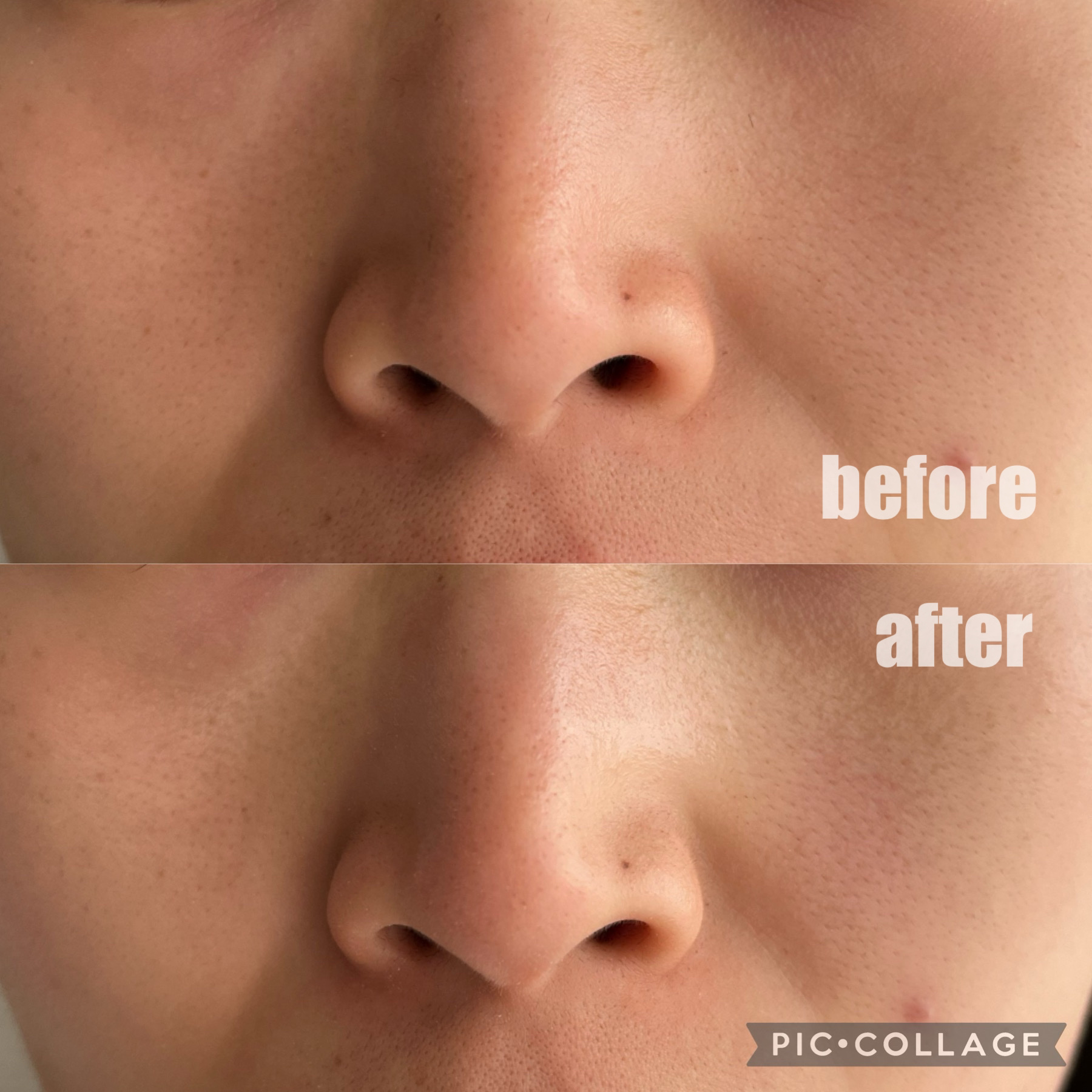 ストロベリーシュガー フードマスク/SKINFOOD/洗い流すパック・マスクを使ったクチコミ（3枚目）