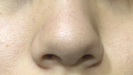 て on LIPS 「【毛穴に悩んでいます】助けてください💦💦💦今高校生で毛穴にずっ..」(4枚目)