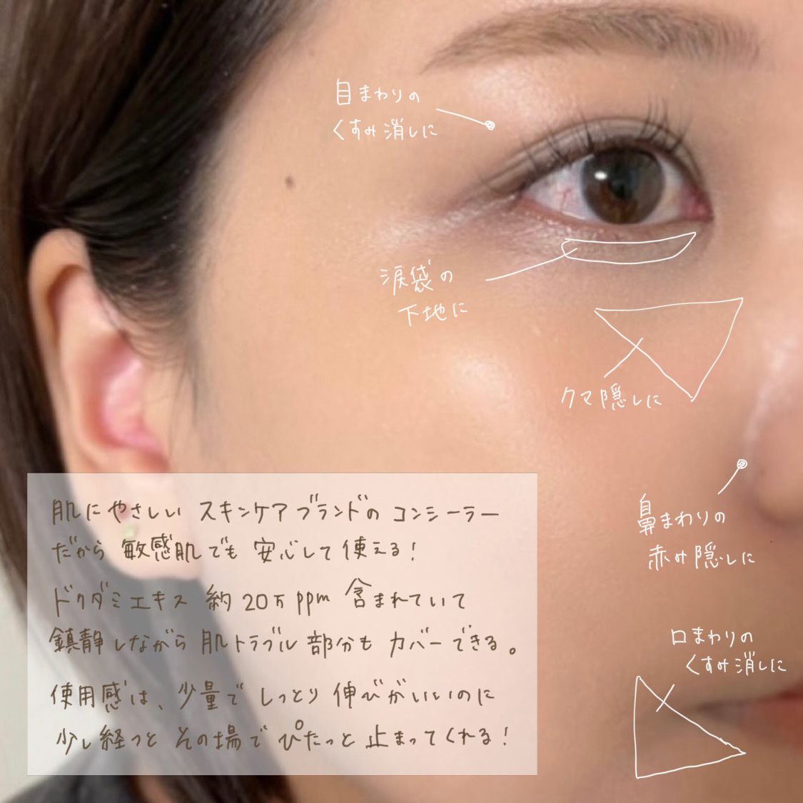 ダーマシンコンシーラー/23years old/リキッドコンシーラーを使ったクチコミ（3枚目）
