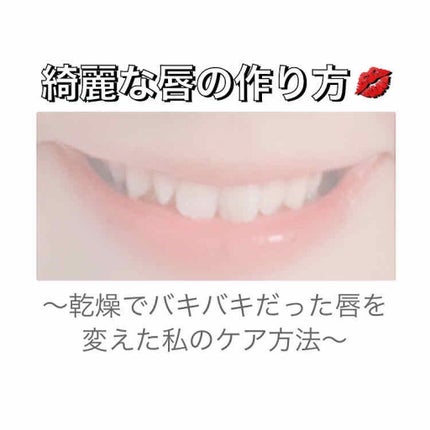 モイスチャーリップ UV/ニベア/リップクリームを使ったクチコミ(1枚目)