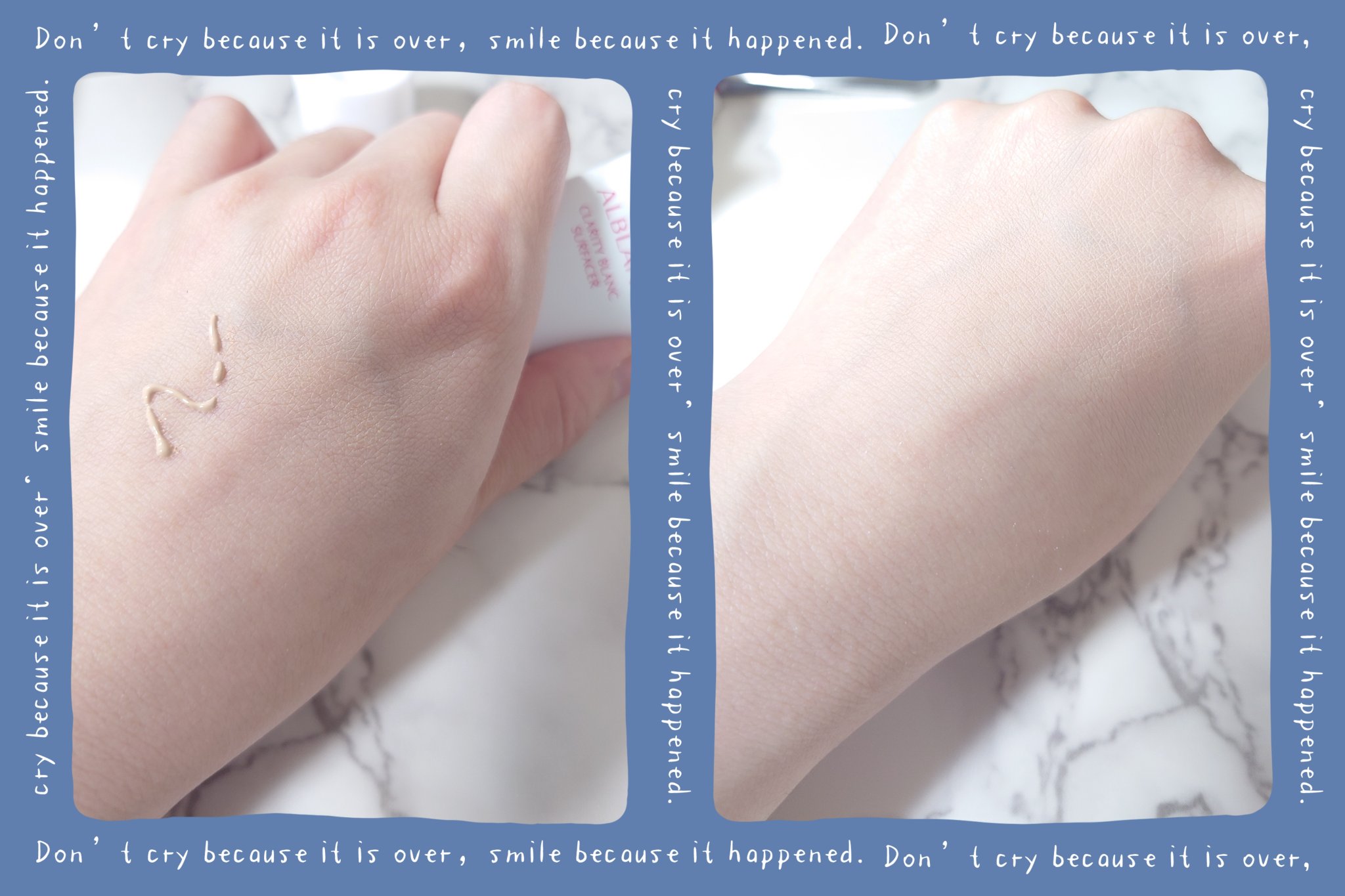 クラリティブラン カモフラチップ/ALBLANC/リキッドコンシーラーを使ったクチコミ（3枚目）