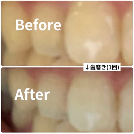 オーラツー プレミアム クレンジングペースト プレミアムミント/オーラツー/歯磨き粉を使ったクチコミ(2枚目)