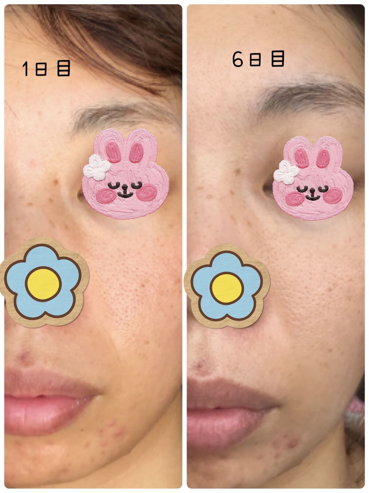 レチノールA 1% アドバンスドリバイタリゼーションクリーム/Life-flo/フェイスクリームを使ったクチコミ（3枚目）